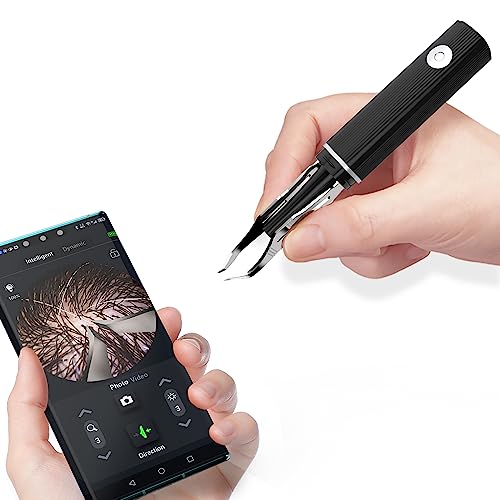Hair Removal Tweezer with 1080p Camera, Ultimate Precision: Tweezer with Camera - Perfect for Delicate Tasks! - - Ear Hair Eyebrow Tweezer
