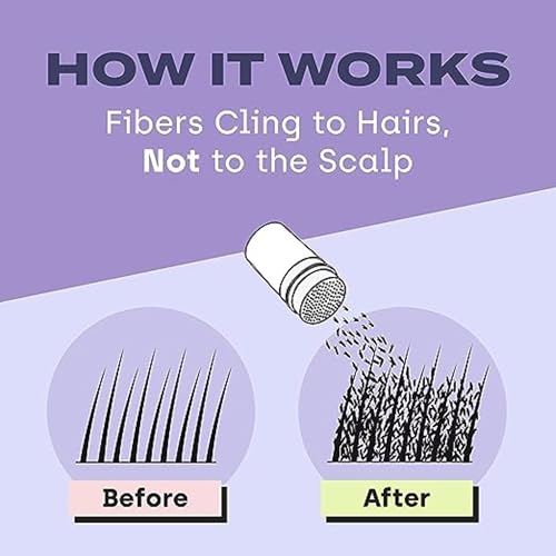 Toppik Hair Building Fibers, Medium Brown, 12g Fill In Fine or Thinning Hair, Instantly Thicker, Fuller Looking, 9 Shades for Men & Women, Keratin Protein Formula