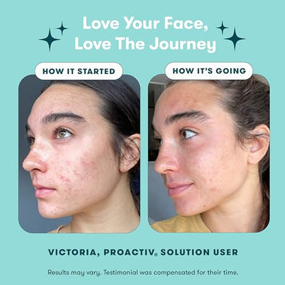 Proactiv Solution Acne Treatment Kit, Original 3-Step Face Routine, 30-Day | Treats and helps prevent acne with a complete 30-day 3-step routine.