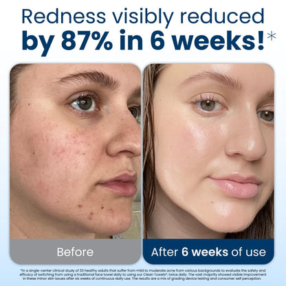 Clean Skin Club Clean Towels XL®, 100% USDA Biobased Face Towel, Disposable Face Towelette, Eczema Association Accepted, Makeup Remover Dry Wipes, Ultra Soft, 50 ct per pack, 6 Packs, 300 Ct Total