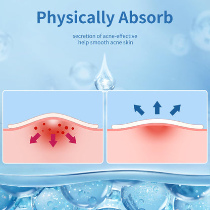 Daolyo Pimple Patches for Face, 4 Size 300 Counts Acne Patches, Hydrocolloid Patches for Covering Zits and Blemishes, Spot Stickers with Salicylic Acid, Tea Tree Oil & Calendula Oil