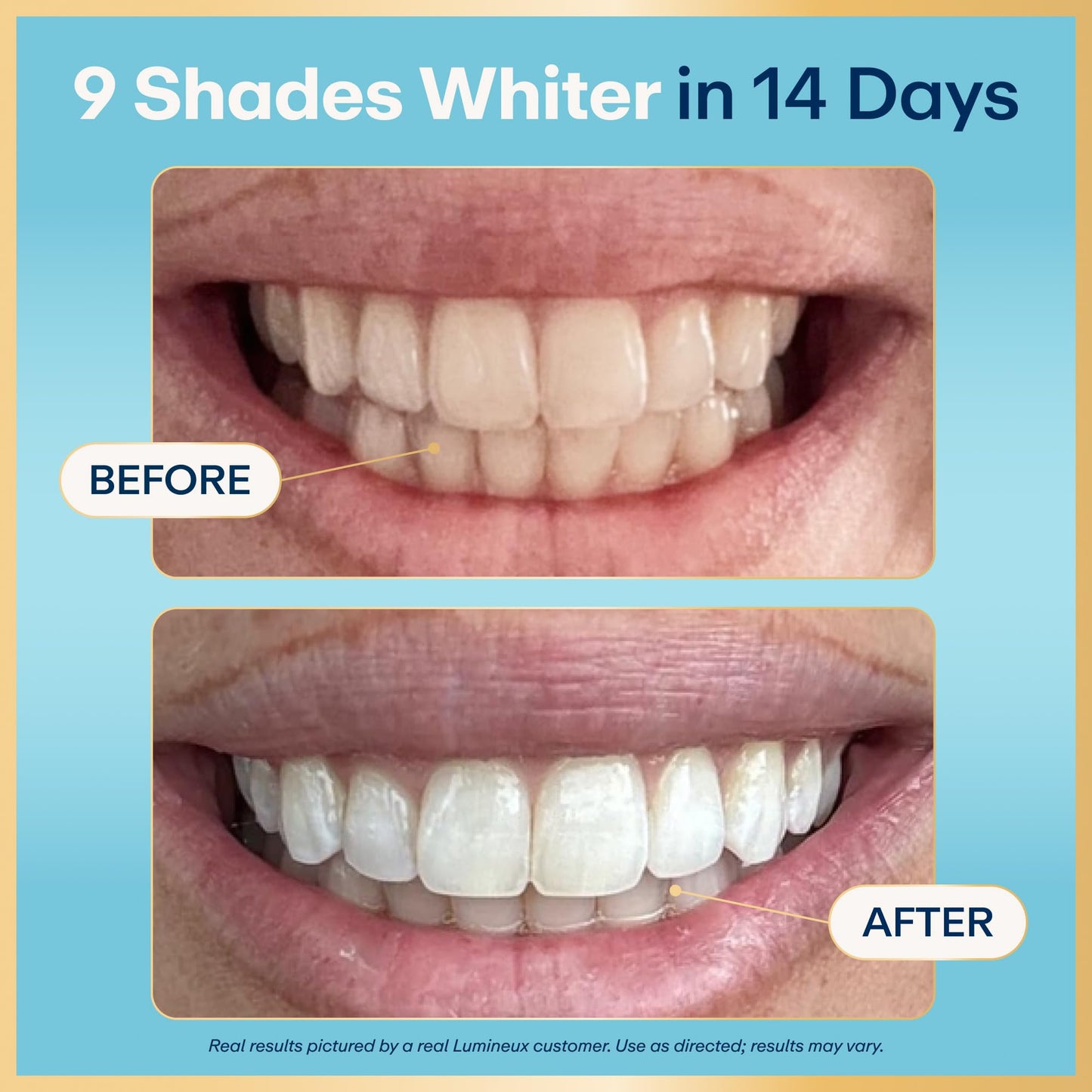 Lumineux Teeth Whitening Strips - 35 Treatments (6 Months) – Peroxide Free - Enamel Safe for Whiter Teeth - Whitening Without The Sensitivity - Dentist Formulated - Sensitivity Free