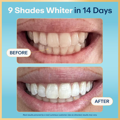 Lumineux Teeth Whitening Strips - 35 Treatments (6 Months) – Peroxide Free - Enamel Safe for Whiter Teeth - Whitening Without The Sensitivity - Dentist Formulated - Sensitivity Free