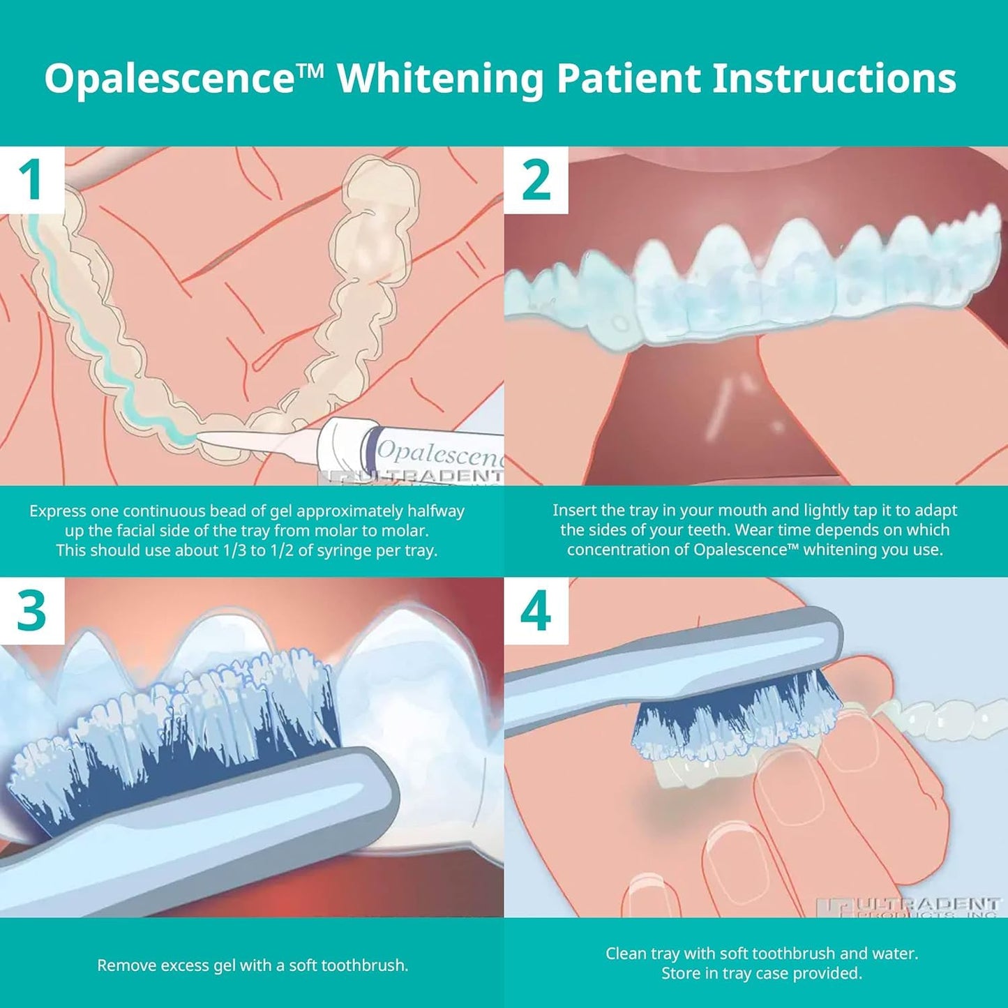 Opalescence 35% CP Mint - Gel Syringes Teeth Whitening - Refill Kit (2 Packs / 4 Syringes Total) Carbamide Peroxide Gel. Made by Ultradent. Tooth Whitening Refill Syringes 5197-2