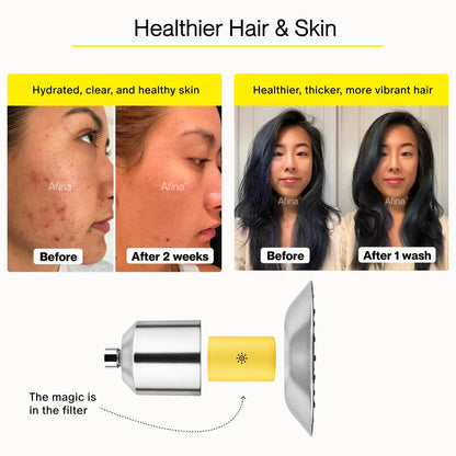 Afina Filtered Shower Head | High Pressure Shower - Reduces Dry Itchy Skin, Dandruff, Eczema, & Dramatically Improves Condition of your Skin, Hair & Nails (Chrome)