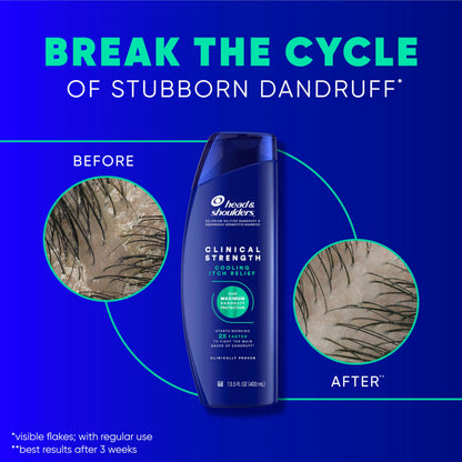 Head & Shoulders Anti-Dandruff Shampoo with 1% Selenium Sulfide, Clinical Strength Intensive Itch Relief Twin Pack, Seborrheic Dermatitis Relief, Itch Relief, 13.5 fl oz Each