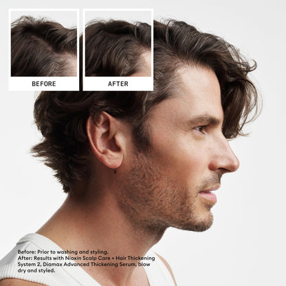Nioxin Scalp + Hair Thickening System 2 | For Natural or Untreated Hair with Progressed Thinning| Full Size| 3 Month Supply